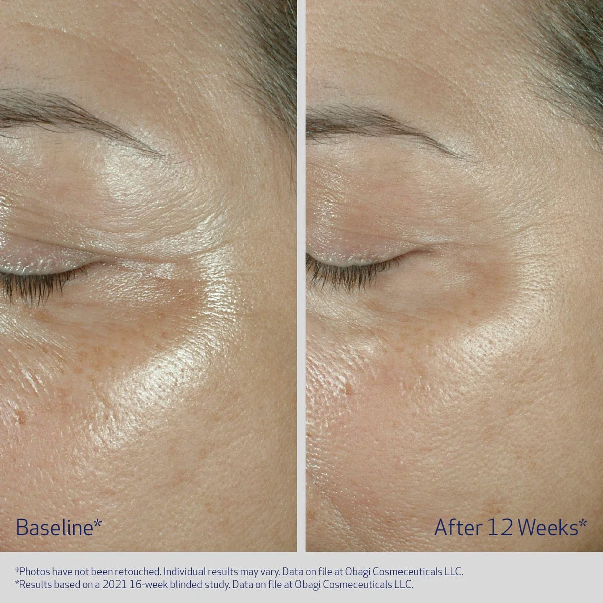 Obagi ELASTIderm Firming Eye Cream tekstura